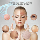 Espátula Ultrasônica Portátil Peeling Facial - Alfashop