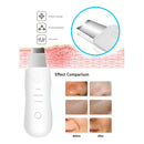 Aparelho De Limpeza Peeling Facial Ultrassônico