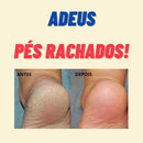 Lixa Elétrica Pés Remove Calos | Alfashop