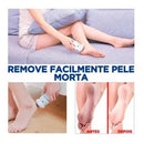 Lixa Elétrica Pés Remove Calos | Alfashop