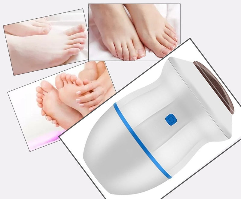 Lixa Elétrica Manicure E Removedor Calo Elétrico Kit Premium - Alfashop