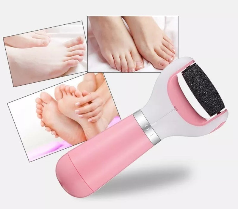 Esfoliador Calo Elétrico Para Pés Usb Lixa Removedor +brinde - Alfashop