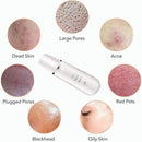 Espátula Ultrasônica Portátil Peeling Facial - Alfashop