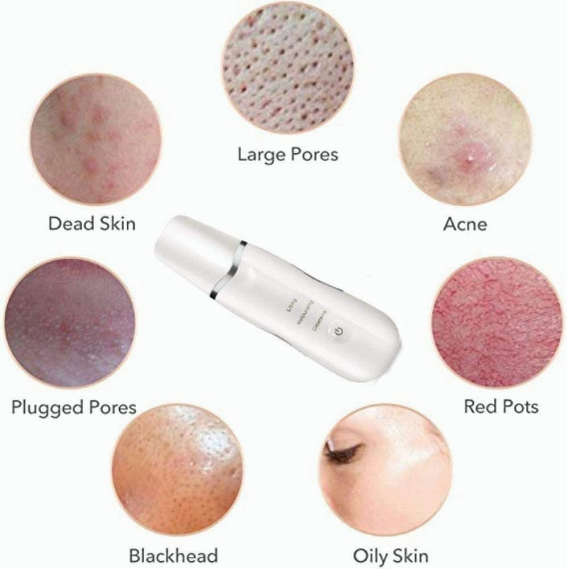 Espátula Ultrasônica Portátil Peeling Facial - Alfashop