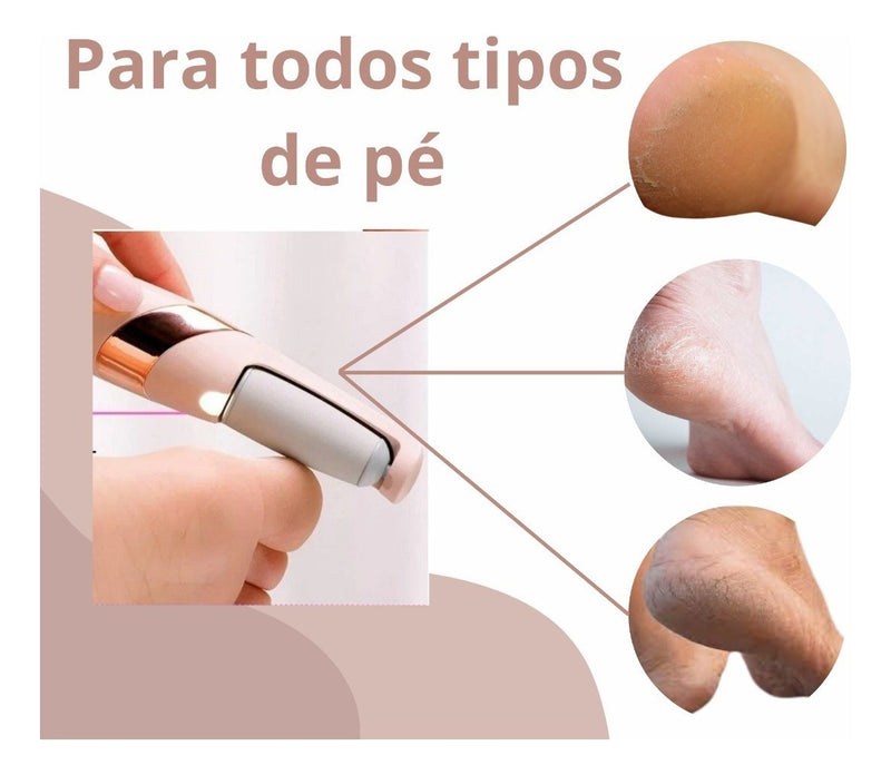 Lixador Para Pés Elétrico E Removedor De Calos Portátil - Alfashop