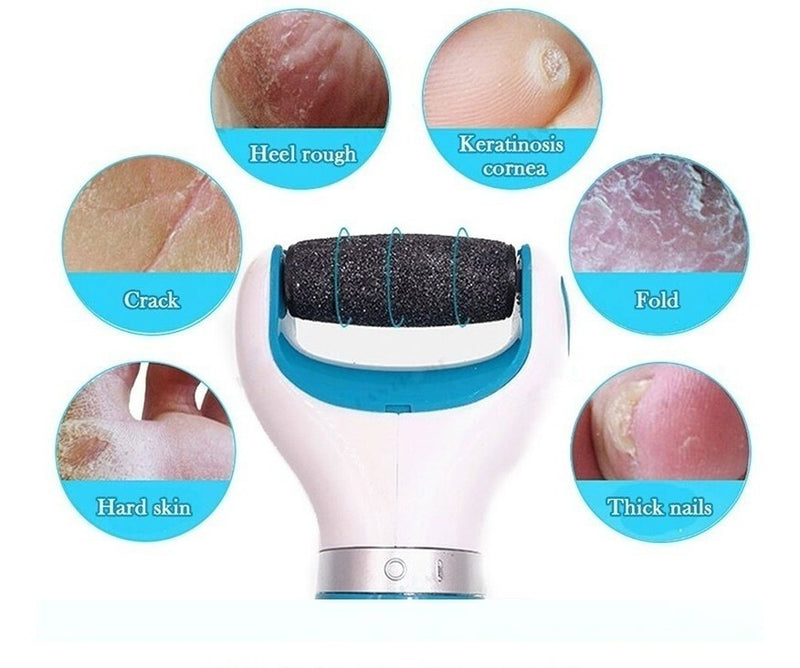Esfoliador Calo Elétrico Para Pés Usb Lixa Removedor +brinde - Alfashop